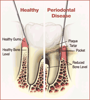 toothdiagram