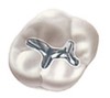 dental fillings