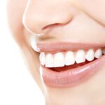 What do you need to know about dental implants?