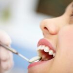 All about the dental implant procedure