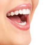 Answers to your questions on dental implants