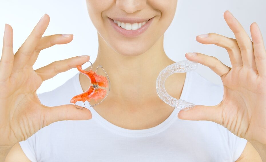 An ill-fitting retainer can cause mouth ulcers.