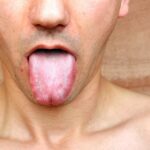 Taking care of your tongue