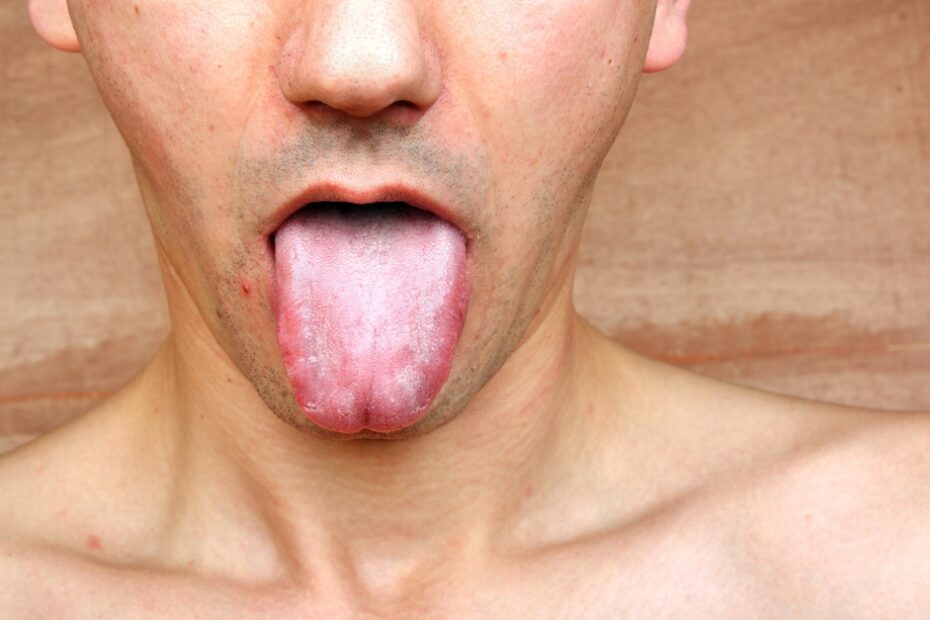 Do you take care of your tongue?