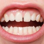 Say it with us: Teeth are not tools