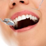 Dental fillings: Aftercare and recovery