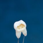 What happens if you avoid the dentist?