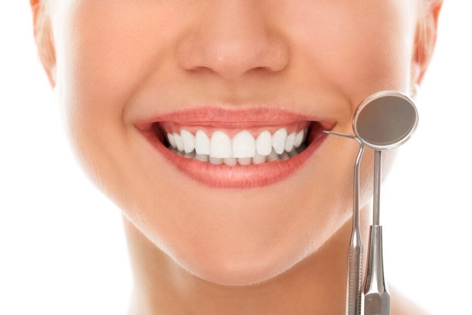 Dental veneers keep your smile looking fresh - but you still have to care for them!