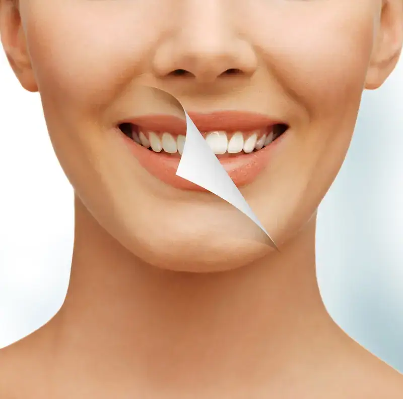 Improve your smile with teeth whitening treatments.