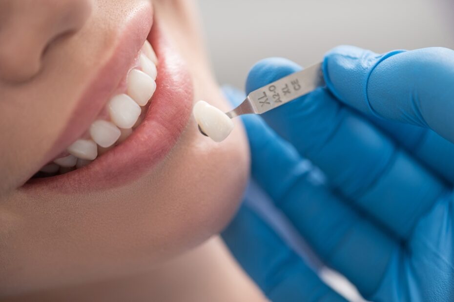 Can a dental crown cure a cracked tooth?