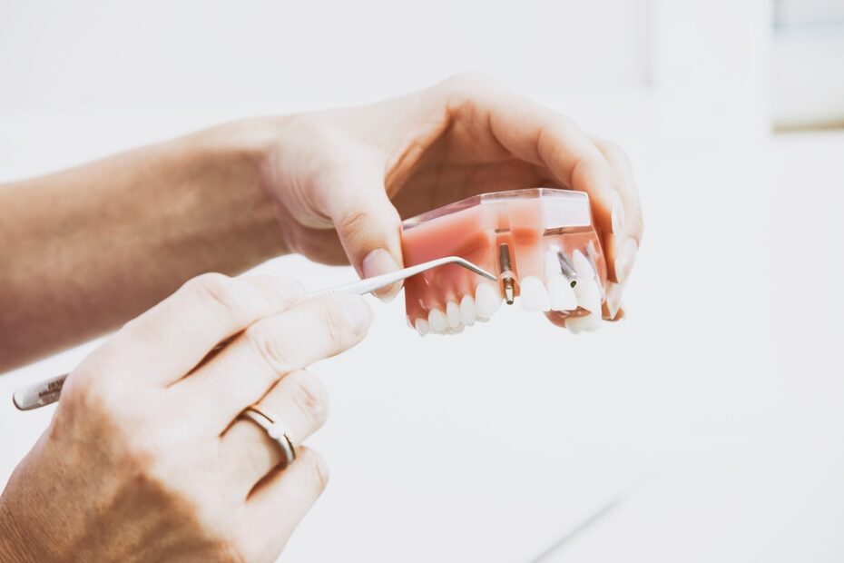 Find out what to do if you have a dental emergency.