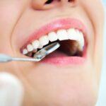Can dental issues cause bad breath?