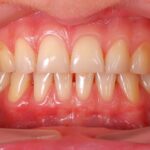 Healthy gums should appear pink to a very light red.